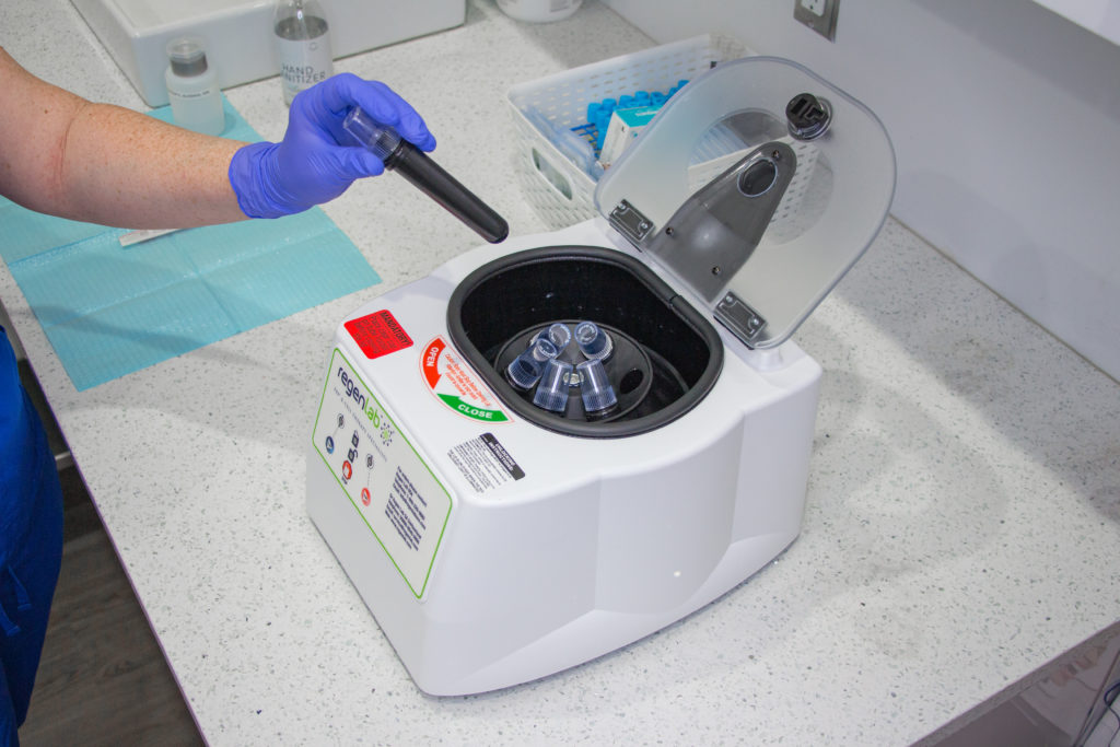 p shot centrifuge - the genomic clininc